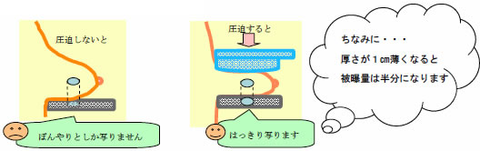 マンモグラフィー